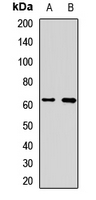 ME2 / Malate Dehydrogenase 2 Antibody