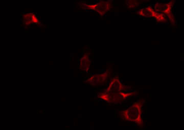 ME2 / Malate Dehydrogenase 2 Antibody - Staining RAW264.7 cells by IF/ICC. The samples were fixed with PFA and permeabilized in 0.1% Triton X-100, then blocked in 10% serum for 45 min at 25°C. The primary antibody was diluted at 1:200 and incubated with the sample for 1 hour at 37°C. An Alexa Fluor 594 conjugated goat anti-rabbit IgG (H+L) Ab, diluted at 1/600, was used as the secondary antibody.