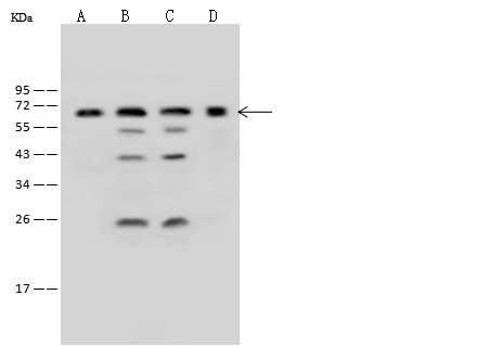 ME2 / Malate Dehydrogenase 2 Antibody - Anti-ME2 rabbit polyclonal antibody at 1:500 dilution. Lane A: 293T Whole Cell Lysate. Lane B: Jurkat Whole Cell Lysate. Lane C: HeLa Whole Cell Lysate. Lane D: K562 Whole Cell Lysate. Lysates/proteins at 30 ug per lane. Secondary: Goat Anti-Rabbit IgG (H+L)/HRP at 1/10000 dilution. Developed using the ECL technique. Performed under reducing conditions. Predicted band size: 65 kDa.