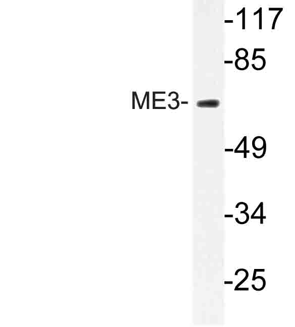 ME3 Antibody - Western blot of ME3 (R576) pAb in extracts from RAW264 cells.