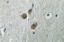 ME3 Antibody - IHC of ME3 (R576) pAb in paraffin-embedded human brain tissue.