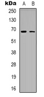ME3 Antibody - Western blot analysis of ME3 expression in HeLa (A); NIH3T3 (B) whole cell lysates.