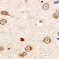 ME3 Antibody - Immunohistochemical analysis of ME3 staining in human brain formalin fixed paraffin embedded tissue section. The section was pre-treated using heat mediated antigen retrieval with sodium citrate buffer (pH 6.0). The section was then incubated with the antibody at room temperature and detected with HRP and DAB as chromogen. The section was then counterstained with hematoxylin and mounted with DPX.