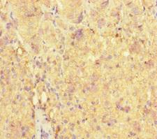 ME3 Antibody - Immunohistochemistry of paraffin-embedded human adrenal gland tissue at dilution of 1:100