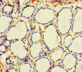 ME3 Antibody - Immunohistochemistry of paraffin-embedded human thyroid tissue at dilution of 1:100