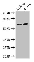 ME3 Antibody - Western Blot Positive WB detected in:Mouse kidney tissue,Mouse brain tissue All Lanes: ME3 antibody at 3ug/ml Secondary Goat polyclonal to rabbit IgG at 1/50000 dilution Predicted band size: 68,39 kDa Observed band size: 68 kDa