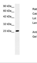 MEAF6 / C1orf149 Antibody - Jurkat Cell Lysate.  This image was taken for the unconjugated form of this product. Other forms have not been tested.
