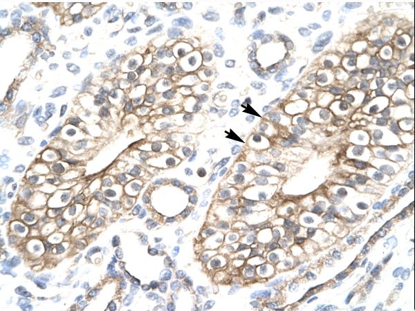 MEAF6 / C1orf149 Antibody - MEAF6 / C1orf149 antibody ARP33354_P050-NP_073593-FLJ11730 Antibody was used in IHC to stain formalin-fixed, paraffin-embedded human kidney.  This image was taken for the unconjugated form of this product. Other forms have not been tested.