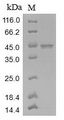 Measles N Protein Protein - (Tris-Glycine gel) Discontinuous SDS-PAGE (reduced) with 5% enrichment gel and 15% separation gel.