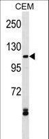 MECOM / EVI1 Antibody - EVI1 Antibody western blot of CEM cell line lysates (35 ug/lane). The EVI1 antibody detected the EVI1 protein (arrow).