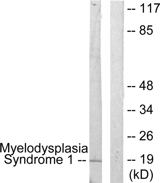 MECOM / EVI1 Antibody - Western blot analysis of lysates from A549 cells, using Myelodysplasia Syndrome 1 Antibody. The lane on the right is blocked with the synthesized peptide.