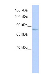MECOM / EVI1 Antibody - MECOM antibody western blot of HeLa lysate.  This image was taken for the unconjugated form of this product. Other forms have not been tested.
