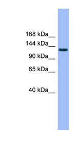 MECOM / EVI1 Antibody - MECOM antibody Western blot of Fetal Kidney lysate. This image was taken for the unconjugated form of this product. Other forms have not been tested.