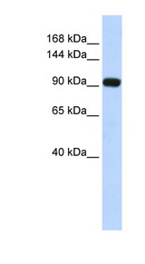 MECOM / EVI1 Antibody - MECOM antibody western blot of human brain lysate.  This image was taken for the unconjugated form of this product. Other forms have not been tested.