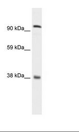MECOM / EVI1 Antibody - Fetal Lung Lysate.  This image was taken for the unconjugated form of this product. Other forms have not been tested.