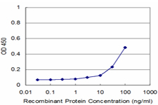 MECOM / EVI1 Antibody - Detection limit for recombinant GST tagged MDS1 is approximately 3 ng/ml as a capture antibody.