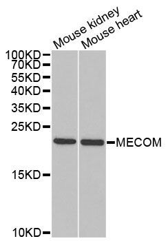 MECOM / EVI1 Antibody - Western blot analysis of extracts of various cell lines.