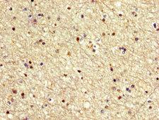 MECOM / EVI1 Antibody - Immunohistochemistry image at a dilution of 1:500 and staining in paraffin-embedded human brain tissue performed on a Leica BondTM system. After dewaxing and hydration, antigen retrieval was mediated by high pressure in a citrate buffer (pH 6.0) . Section was blocked with 10% normal goat serum 30min at RT. Then primary antibody (1% BSA) was incubated at 4 °C overnight. The primary is detected by a biotinylated secondary antibody and visualized using an HRP conjugated SP system.