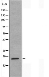 MECOM / EVI1 Antibody - Western blot analysis of extracts of A549 cells using Myelodysplasia Syndrome 1 antibody.