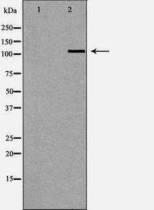 MECOM / EVI1 Antibody - Western blot analysis of rat lung tissue lysate using MDS1 antibody. The lane on the left is treated with the antigen-specific peptide.
