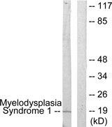 MECOM / EVI1 Antibody - Western blot analysis of extracts from A549 cells, using Myelodysplasia Syndrome 1 antibody.