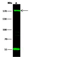 MECOM / EVI1 Antibody - Anti-MECOM rabbit polyclonal antibody at 1:500 dilution. Lane A: A549 Whole Cell Lysate. Lysates/proteins at 30 ug per lane. Secondary: Goat Anti-Rabbit IgG H&L (Dylight800) at 1/10000 dilution. Developed using the Odyssey technique. Performed under reducing conditions. Predicted band size: 118 kDa. Observed band size: 170 kDa. (We are unsure as to the identity of these extra bands.)