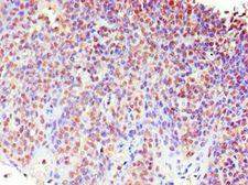 MECP2 Antibody - Immunohistochemistry of paraffin-embedded human tonsil using antibody at 1:100 dilution.