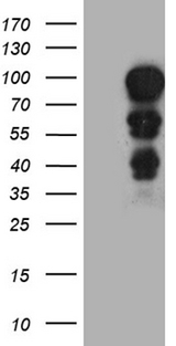 MECP2 Antibody - HEK293T cells were transfected with the pCMV6-ENTRY control. (Left lane) or pCMV6-ENTRY MECP2. (Right lane) cDNA for 48 hrs and lysed