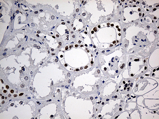 MECP2 Antibody - Immunohistochemical staining of paraffin-embedded Human Kidney tissue within the normal limits using anti-MECP2 mouse monoclonal antibody. (Heat-induced epitope retrieval by 1mM EDTA in 10mM Tris buffer. (pH8.5) at 120°C for 3 min. (1:150)
