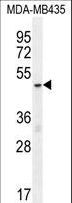 MECP2 Antibody - MeCP2 Antibody (pS80) western blot of MDA-MB435 cell line lysates (35 ug/lane). The MeCP2 antibody detected the MeCP2 protein (arrow).