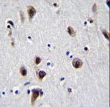 MECP2 Antibody - MeCP2 Antibody (N-term S80) immunohistochemistry of formalin-fixed and paraffin-embedded human brain tissue followed by peroxidase-conjugated secondary antibody and DAB staining.