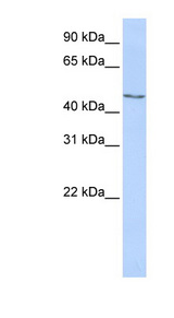 MECP2 Antibody - MECP2 antibody Western blot of HepG2 cell lysate. This image was taken for the unconjugated form of this product. Other forms have not been tested.