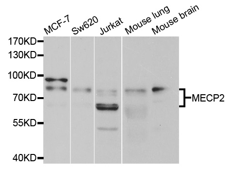 MECP2 Antibody - Western blot analysis of extracts of various cell lines, using MECP2 antibody.