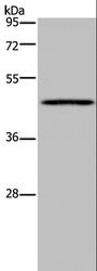 MECP2 Antibody - Western blot analysis of Mouse lung tissue, using MECP2 Polyclonal Antibody at dilution of 1:300.