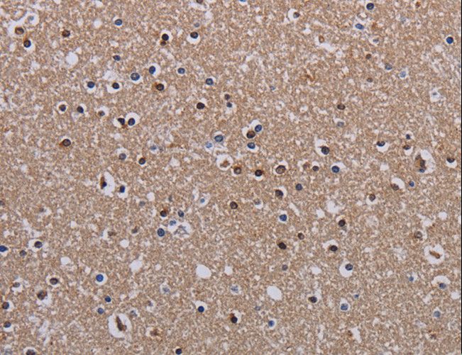 MECP2 Antibody - Immunohistochemistry of paraffin-embedded Human brain using MECP2 Polyclonal Antibody at dilution of 1:60.