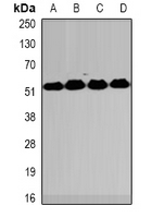 MECP2 Antibody - Western blot analysis of MeCP2 expression in HT29 (A); Jurkat (B); mouse spleen (C); mouse lung (D) whole cell lysates.