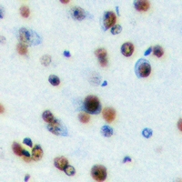 MECP2 Antibody - Immunohistochemical analysis of MeCP2 staining in mouse brain formalin fixed paraffin embedded tissue section. The section was pre-treated using heat mediated antigen retrieval with sodium citrate buffer (pH 6.0). The section was then incubated with the antibody at room temperature and detected using an HRP conjugated compact polymer system. DAB was used as the chromogen. The section was then counterstained with hematoxylin and mounted with DPX.