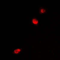 MECP2 Antibody - Immunofluorescent analysis of MeCP2 staining in U2OS cells. Formalin-fixed cells were permeabilized with 0.1% Triton X-100 in TBS for 5-10 minutes and blocked with 3% BSA-PBS for 30 minutes at room temperature. Cells were probed with the primary antibody in 3% BSA-PBS and incubated overnight at 4 deg C in a humidified chamber. Cells were washed with PBST and incubated with a DyLight 594-conjugated secondary antibody (red) in PBS at room temperature in the dark.