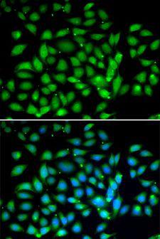 MECP2 Antibody - Immunofluorescence analysis of U2OS cells using MECP2 antibody. Blue: DAPI for nuclear staining.