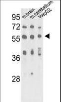 MECP2 Antibody - Western blot of MeCP2-S421* in mouse brain, cerebellum tissue and HepG2 cell line lysates (35 ug/lane). CP2 (arrow) was detected using the purified antibody.