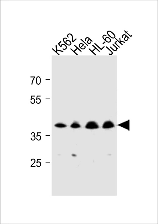 MECR Antibody - MECR Antibody western blot of K562,HeLa,HL-60,Jurkat cell line lysates (35 ug/lane). The MECR antibody detected the MECR protein (arrow).