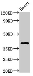 MECR Antibody - Western Blot Positive WB detected in: Rat heart tissue All lanes: MECR antibody at 3.3µg/ml Secondary Goat polyclonal to rabbit IgG at 1/50000 dilution Predicted band size: 41, 33 kDa Observed band size: 41 kDa
