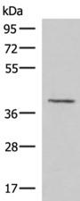 MECR Antibody - Western blot analysis of Human fetal brain tissue lysate  using MECR Polyclonal Antibody at dilution of 1:1000