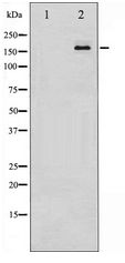 MED1 / TRAP220 Antibody - Western blot of PPAR-BP expression in HUVEC whole cell lysates,The lane on the left is treated with the antigen-specific peptide.