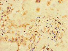MED1 / TRAP220 Antibody - Immunohistochemistry of paraffin-embedded human placenta tissue at dilution of 1:100