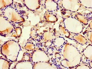 MED1 / TRAP220 Antibody - Immunohistochemistry of paraffin-embedded human thyroid tissue at dilution of 1:100