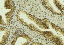 MED1 / TRAP220 Antibody - 1:100 staining mouse colon tissue by IHC-P. The sample was formaldehyde fixed and a heat mediated antigen retrieval step in citrate buffer was performed. The sample was then blocked and incubated with the antibody for 1.5 hours at 22°C. An HRP conjugated goat anti-rabbit antibody was used as the secondary.