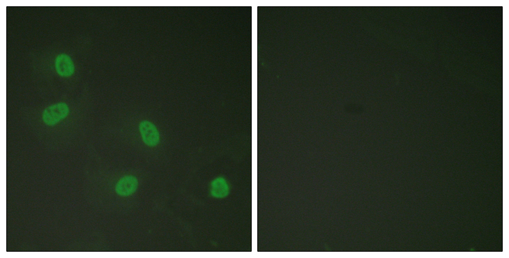 MED1 / TRAP220 Antibody - Immunofluorescence analysis of HeLa cells, using PPAR-BP (Phospho-Thr1457) Antibody. The picture on the right is blocked with the phospho peptide.