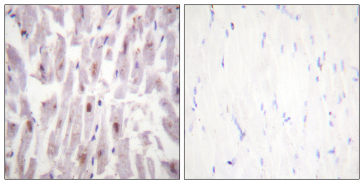 MED1 / TRAP220 Antibody - Immunohistochemistry analysis of paraffin-embedded human heart, using PPAR-BP (Phospho-Thr1457) Antibody. The picture on the right is blocked with the phospho peptide.
