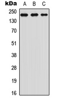 MED1 / TRAP220 Antibody - Western blot analysis of TRAP220 (pT1457) expression in Jurkat (A); HeLa (B); NIH3T3 (C) whole cell lysates.